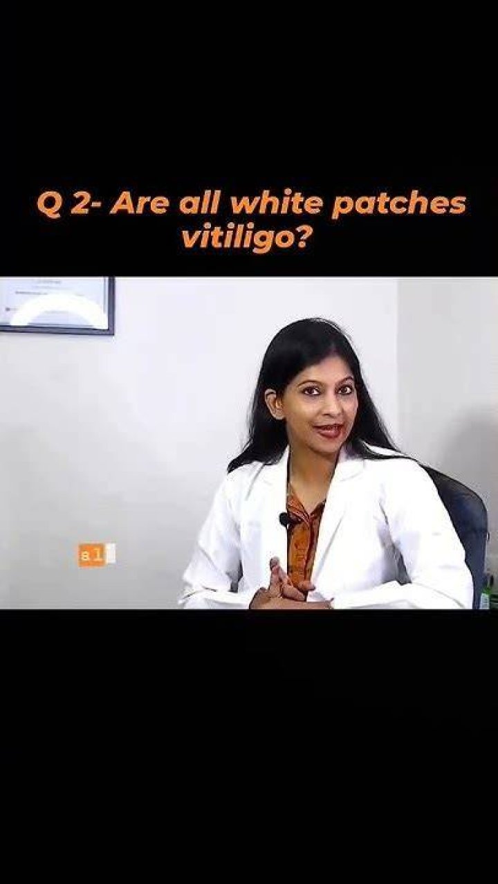 Are all white patches vitiligo?
