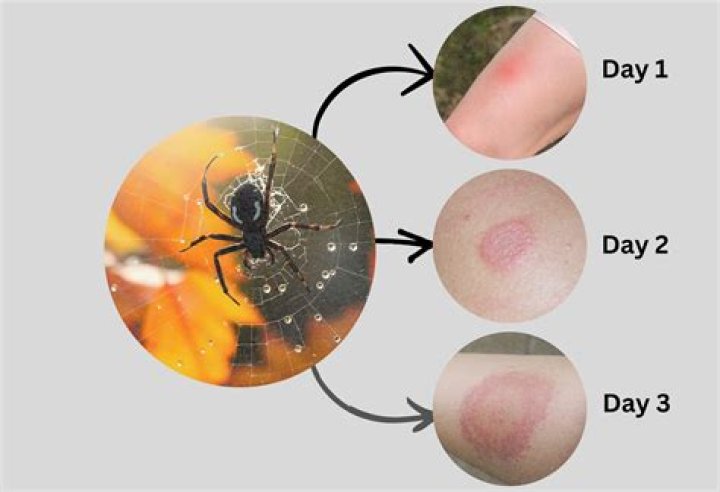 Can a spider go into your ear?