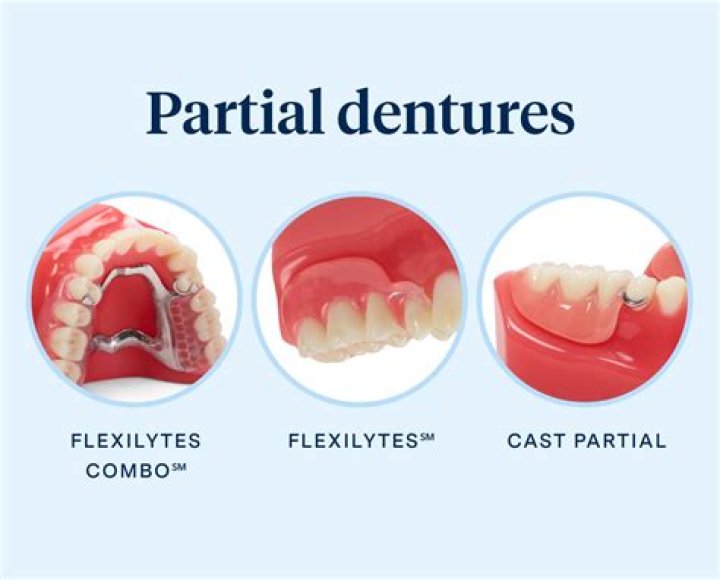 Can I get a partial denture with no back teeth?