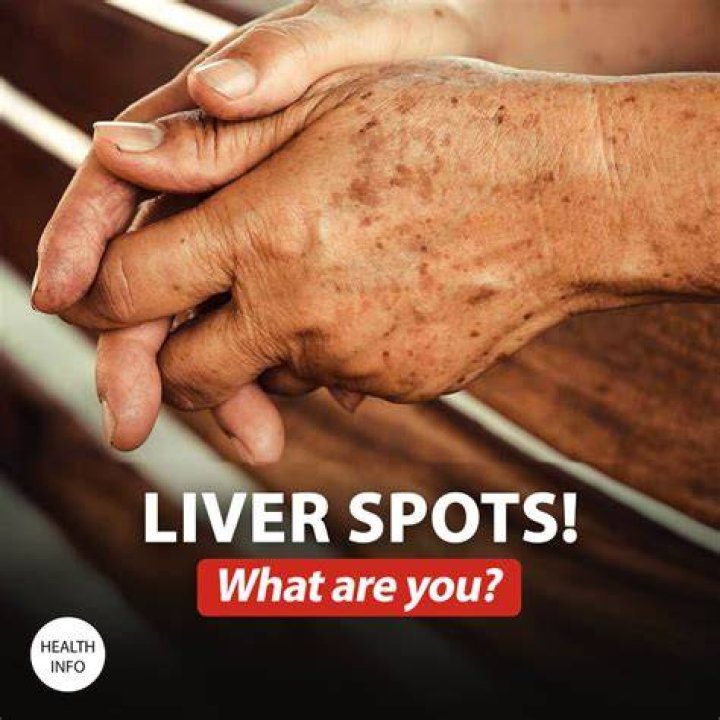 Can liver spots turn cancerous?