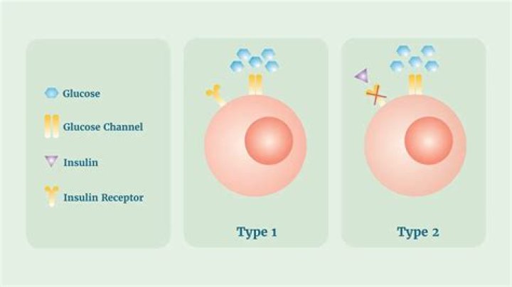 Can type 1 diabetes turn to Type 2?