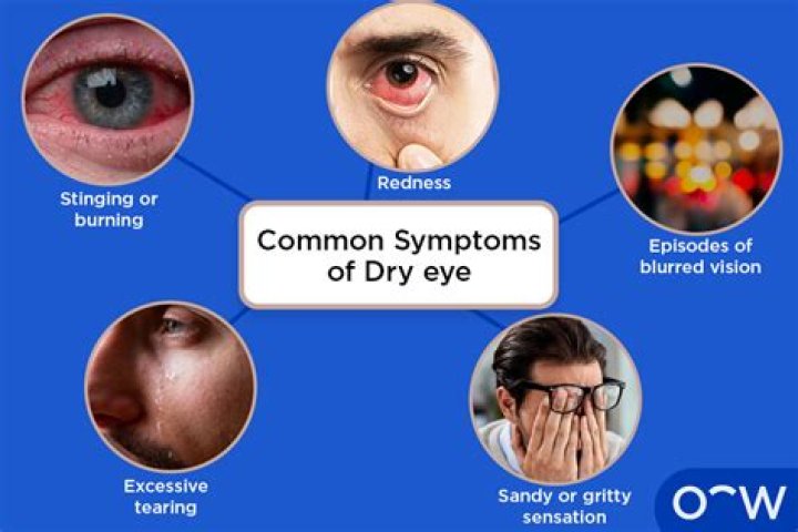 Can vitamins cause dry eyes?