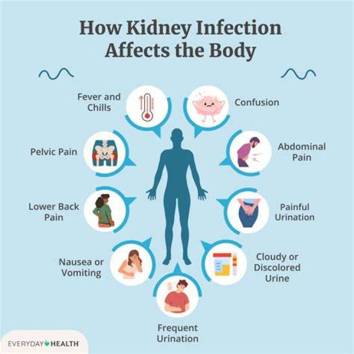 Can you have a kidney infection without pain when urinating?
