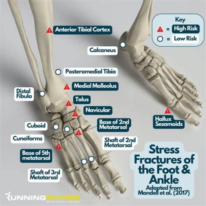 Can you move your ankle if it's fractured?