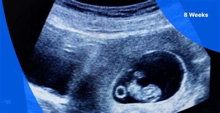 Can you show at 8 weeks?