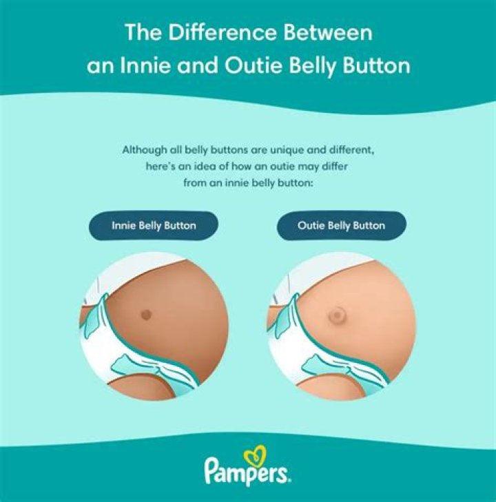 Can your belly button untie?