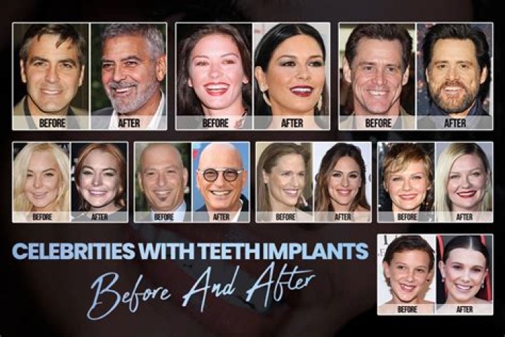 Do all celebrities get their teeth fixed?