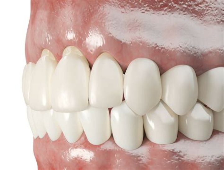 Do burnt gums grow back?