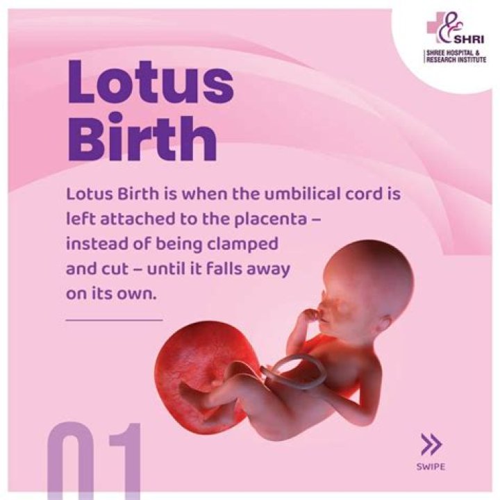 Do hospitals allow Lotus births?