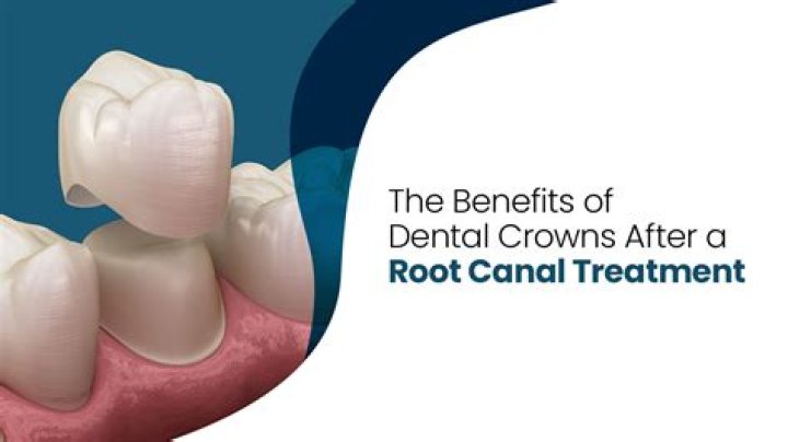 Do I need antibiotics after a crown?