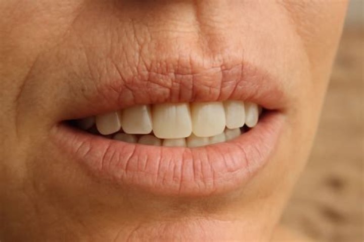 Do people plant teeth?