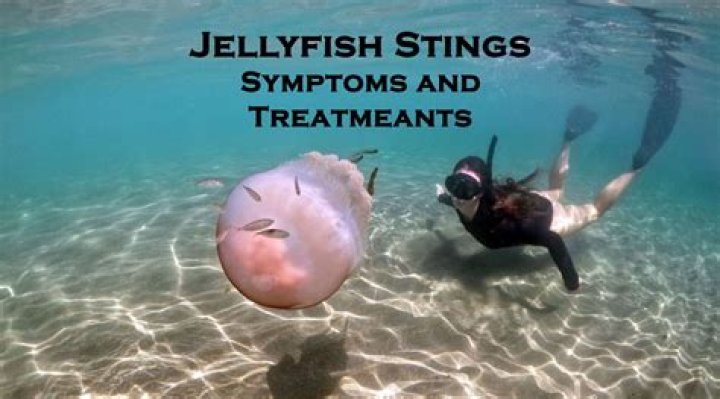 Do sharks get stung by jellyfish?