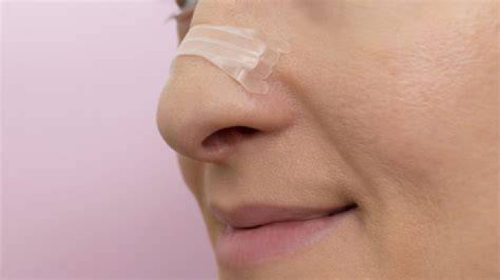 Do snore strips work?