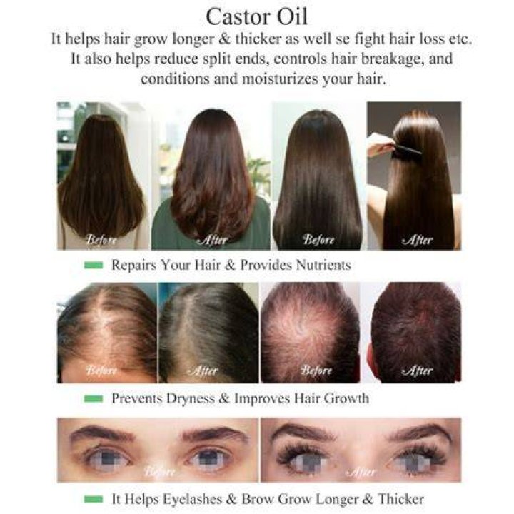 Does Castor Oil Help hair growth?