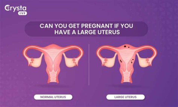 Does enlarged uterus cause big belly?