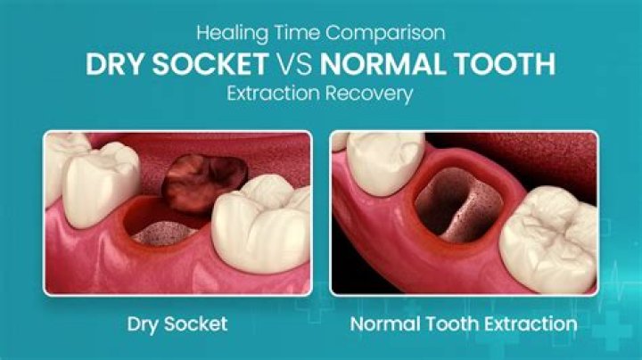 Does having a tooth removed affect other teeth?