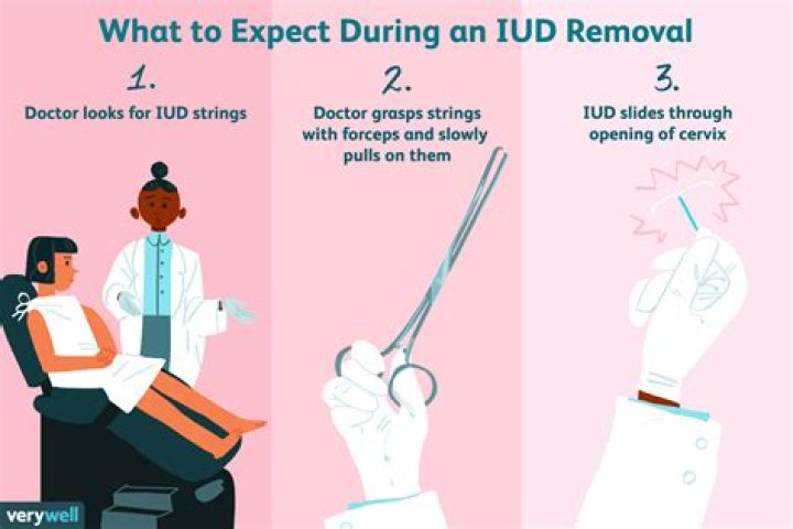 Does IUD removal hurt?