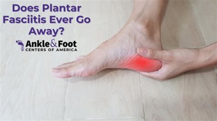 Does plantar fasciitis throb at night?