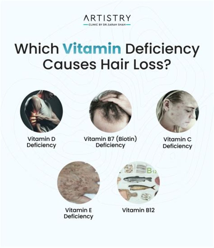 Does vitamin D3 cause hair loss?