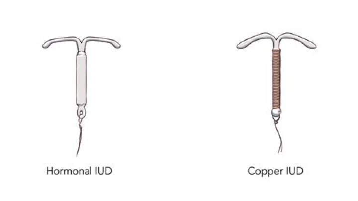 How do I prepare for an IUD?