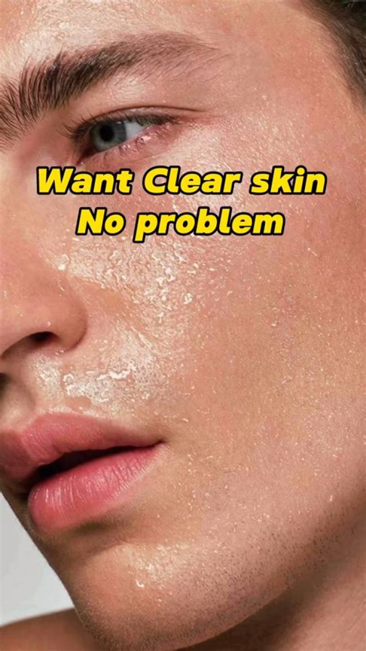 How do teens get perfect skin?