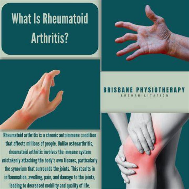 How do you beat rheumatoid arthritis?