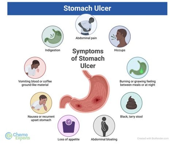 How do you check for ulcer pain?