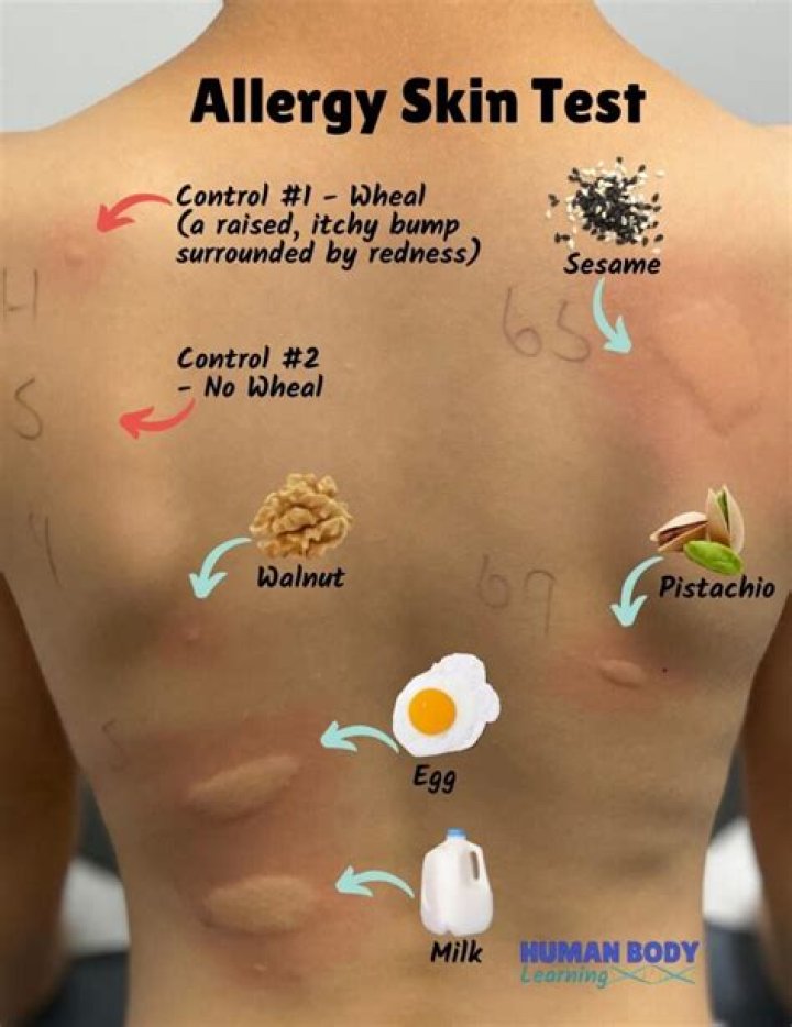 How do you know if you are allergic to almond milk?