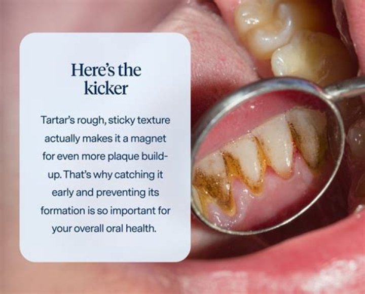 How do you remove tartar with a pick?