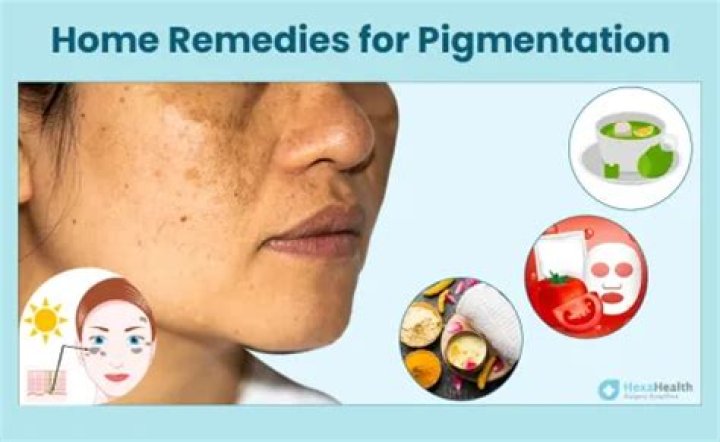 How do you Repigment white spots?
