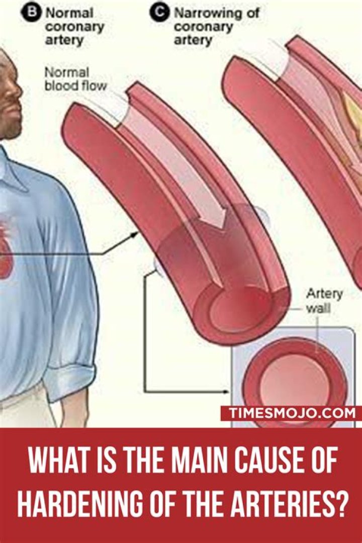 How do you reverse hardening of the arteries?