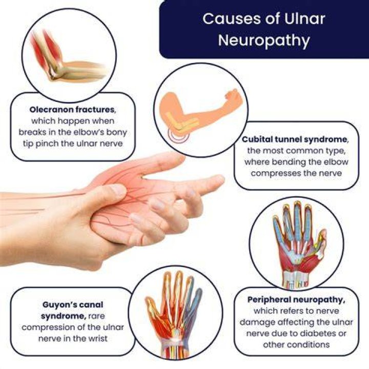 How do you treat nerve pain in your wrist?