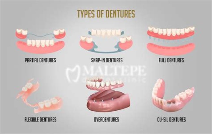 How does it feel to have dentures?