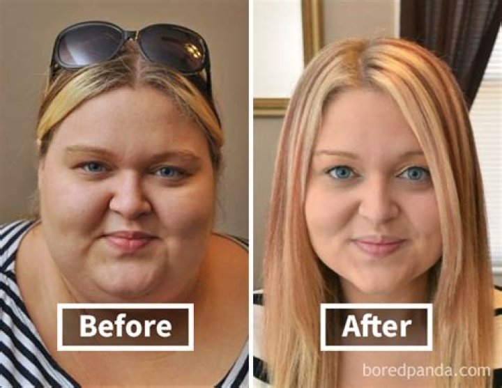 How does losing weight change your face?