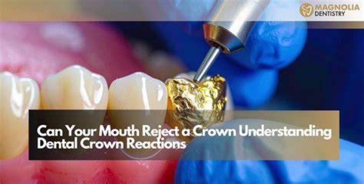 How hot can your mouth handle?