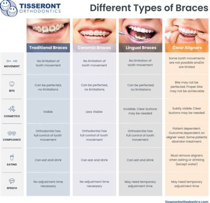 How long is too long for braces?