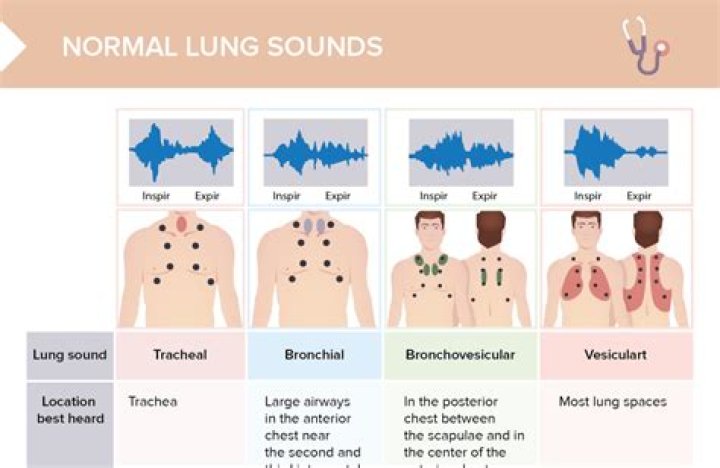 How many fart sounds are there?
