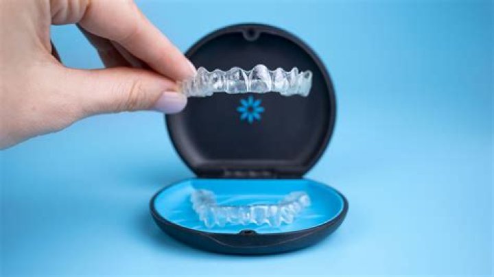 Is 50 trays a lot Invisalign?