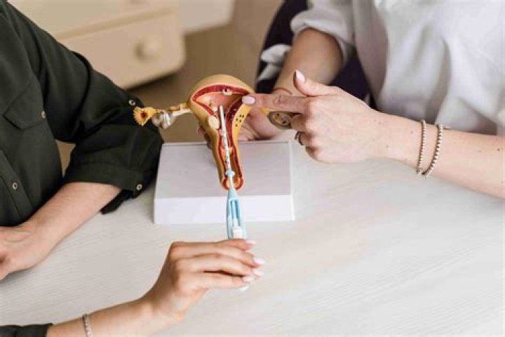 Is an IUD healthier than the pill?