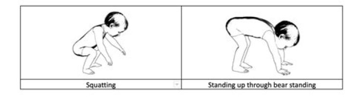 Is it bad for babies to stand too early?