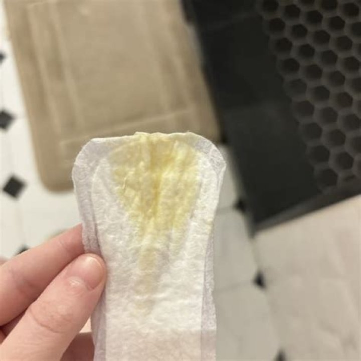 Is light yellow discharge normal?