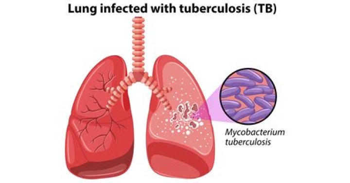 Is tea good for tuberculosis?