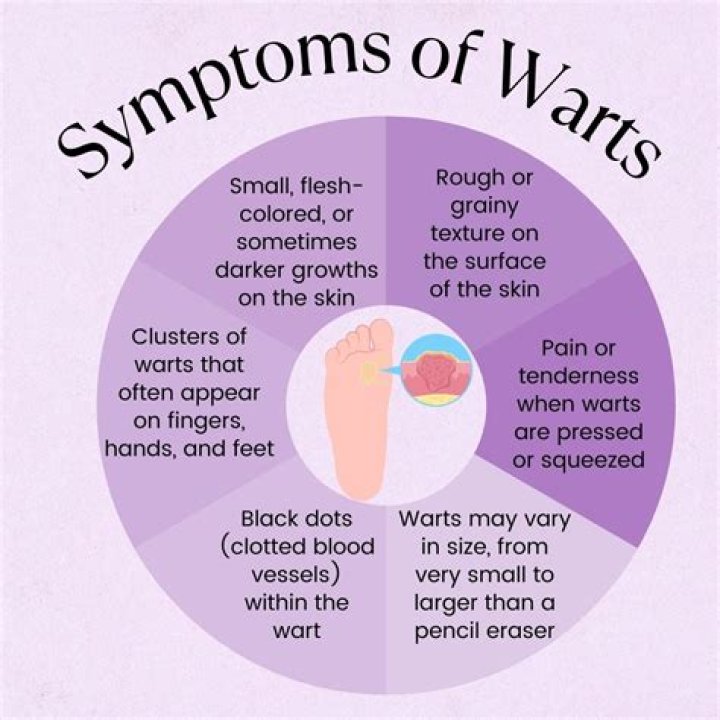 Is touching a wart contagious?