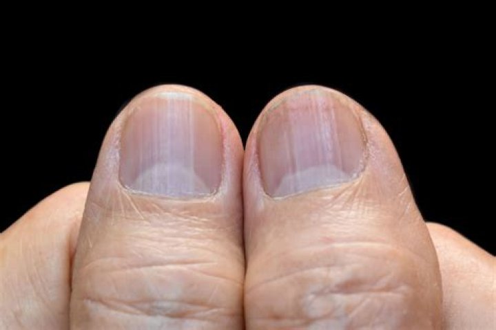 What are good Nailbeds?