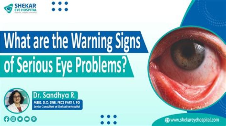 What are symptoms of serious eye problems?