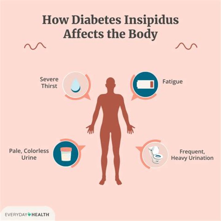 What are the 4 P's of diabetes?