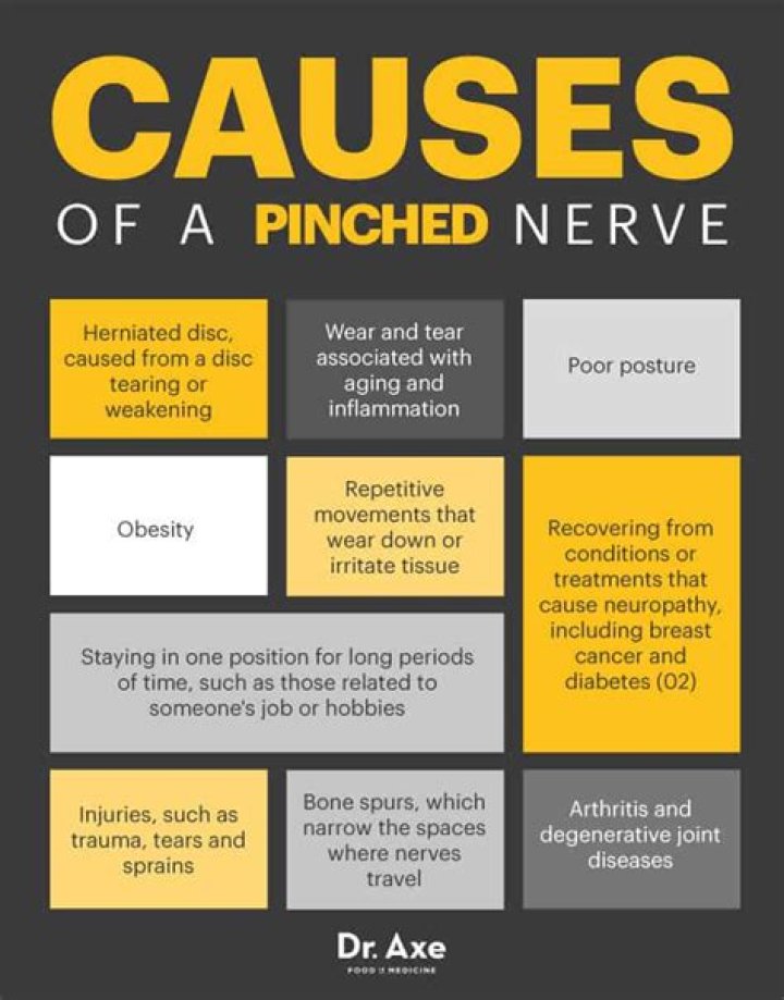 What causes a pinched nerve?