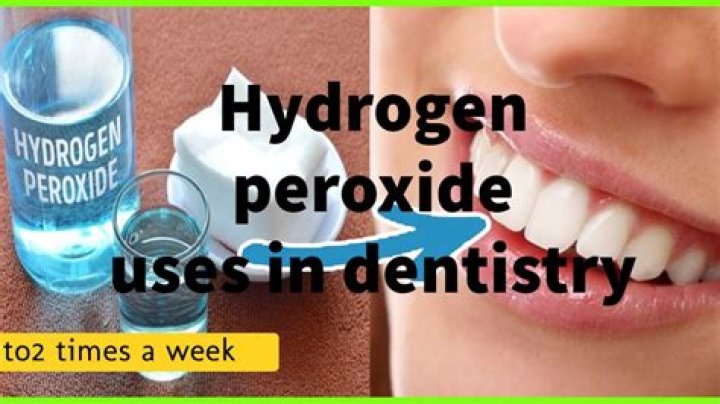 What does peroxide do to your teeth?