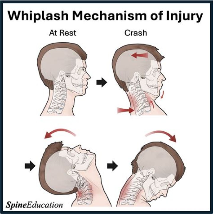 What happens to whiplash on The Unit?
