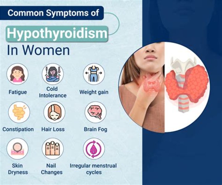 What is a normal thyroid level in a woman?